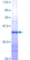 FEN1 Protein - 12.5% SDS-PAGE Stained with Coomassie Blue.