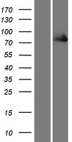 FERMT1 / Kindlin Protein - Western validation with an anti-DDK antibody * L: Control HEK293 lysate R: Over-expression lysate
