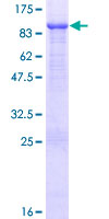 FERMT1 / Kindlin Protein - 12.5% SDS-PAGE of human FERMT1 stained with Coomassie Blue