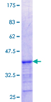 FERMT1 / Kindlin Protein - 12.5% SDS-PAGE Stained with Coomassie Blue.