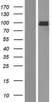 FES Protein - Western validation with an anti-DDK antibody * L: Control HEK293 lysate R: Over-expression lysate