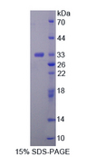 FES Protein - Recombinant  Feline Sarcoma Oncogene By SDS-PAGE