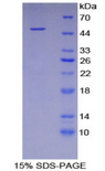 FETUB / Fetuin B Protein - Recombinant Fetuin B By SDS-PAGE