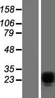 FEV / PET1 Protein - Western validation with an anti-DDK antibody * L: Control HEK293 lysate R: Over-expression lysate