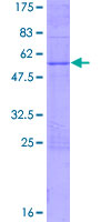 FEV / PET1 Protein - 12.5% SDS-PAGE of human FEV stained with Coomassie Blue