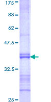 FEV / PET1 Protein - 12.5% SDS-PAGE Stained with Coomassie Blue.