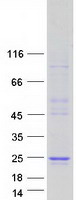 FEV / PET1 Protein - Purified recombinant protein FEV was analyzed by SDS-PAGE gel and Coomassie Blue Staining