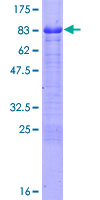 FEZ1 Protein - 12.5% SDS-PAGE of human FEZ1 stained with Coomassie Blue