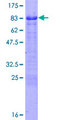 FEZ1 Protein - 12.5% SDS-PAGE of human FEZ1 stained with Coomassie Blue