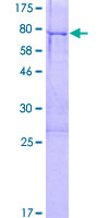 FEZL / FEZF2 Protein - 12.5% SDS-PAGE of human FEZF2 stained with Coomassie Blue