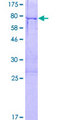 FEZL / FEZF2 Protein - 12.5% SDS-PAGE of human FEZF2 stained with Coomassie Blue
