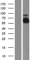 FGA / Fibrinogen Alpha Protein - Western validation with an anti-DDK antibody * L: Control HEK293 lysate R: Over-expression lysate