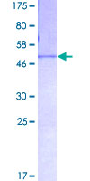 FGA / Fibrinogen Alpha Protein - 12.5% SDS-PAGE of human FGA stained with Coomassie Blue