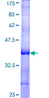 FGB / Fibrinogen Beta Chain Protein - 12.5% SDS-PAGE Stained with Coomassie Blue.