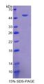 FGB / Fibrinogen Beta Chain Protein - Recombinant Fibrinogen Beta By SDS-PAGE
