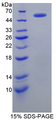 FGB / Fibrinogen Beta Chain Protein - Recombinant Fibrinogen Beta By SDS-PAGE