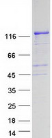 FGD1 Protein - Purified recombinant protein FGD1 was analyzed by SDS-PAGE gel and Coomassie Blue Staining