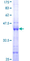 FGD3 Protein - 12.5% SDS-PAGE Stained with Coomassie Blue.