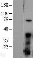 FGF1 / Acidic FGF Protein - Western validation with an anti-DDK antibody * L: Control HEK293 lysate R: Over-expression lysate