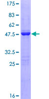 FGF1 / Acidic FGF Protein - 12.5% SDS-PAGE of human FGF1 stained with Coomassie Blue