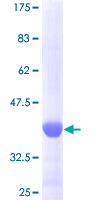FGF1 / Acidic FGF Protein - 12.5% SDS-PAGE Stained with Coomassie Blue.