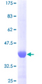 FGF1 / Acidic FGF Protein - 12.5% SDS-PAGE Stained with Coomassie Blue.