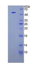 FGF1 / Acidic FGF Protein - Active Fibroblast Growth Factor 1, Acidic (FGF1) by SDS-PAGE