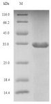 FGF10 Protein - (Tris-Glycine gel) Discontinuous SDS-PAGE (reduced) with 5% enrichment gel and 15% separation gel.