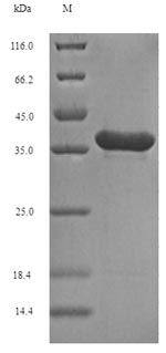 FGF10 Protein - (Tris-Glycine gel) Discontinuous SDS-PAGE (reduced) with 5% enrichment gel and 15% separation gel.