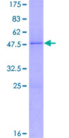 FGF10 Protein - 12.5% SDS-PAGE of human FGF10 stained with Coomassie Blue