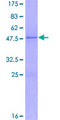 FGF10 Protein - 12.5% SDS-PAGE of human FGF10 stained with Coomassie Blue
