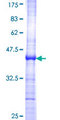 FGF10 Protein - 12.5% SDS-PAGE Stained with Coomassie Blue.