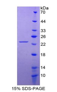 FGF10 Protein - Recombinant Fibroblast Growth Factor 10 By SDS-PAGE