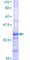 FGF11 / FGF-11 Protein - 12.5% SDS-PAGE Stained with Coomassie Blue.