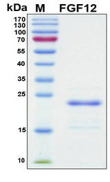FGF12 Protein - SDS-PAGE under reducing conditions and visualized by Coomassie blue staining