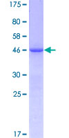 FGF12 Protein - 12.5% SDS-PAGE of human FGF12 stained with Coomassie Blue