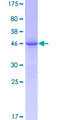 FGF12 Protein - 12.5% SDS-PAGE of human FGF12 stained with Coomassie Blue
