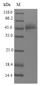 FGF12 Protein - (Tris-Glycine gel) Discontinuous SDS-PAGE (reduced) with 5% enrichment gel and 15% separation gel.