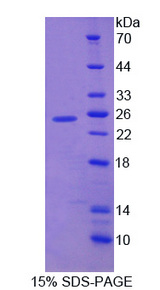 FGF12 Protein - Recombinant Fibroblast Growth Factor 12 By SDS-PAGE