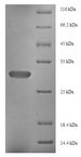 FGF13 Protein - (Tris-Glycine gel) Discontinuous SDS-PAGE (reduced) with 5% enrichment gel and 15% separation gel.