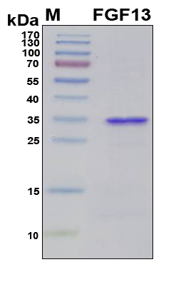 FGF13 Protein - SDS-PAGE under reducing conditions and visualized by Coomassie blue staining