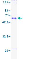 FGF13 Protein - 12.5% SDS-PAGE of human FGF13 stained with Coomassie Blue