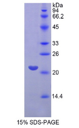 FGF13 Protein - Recombinant Fibroblast Growth Factor 13 By SDS-PAGE
