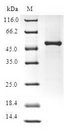FGF14 Protein - (Tris-Glycine gel) Discontinuous SDS-PAGE (reduced) with 5% enrichment gel and 15% separation gel.