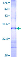 FGF14 Protein - 12.5% SDS-PAGE Stained with Coomassie Blue.