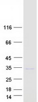 FGF14 Protein - Purified recombinant protein FGF14 was analyzed by SDS-PAGE gel and Coomassie Blue Staining