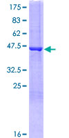 FGF16 Protein - 12.5% SDS-PAGE of human FGF16 stained with Coomassie Blue