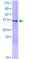 FGF16 Protein - 12.5% SDS-PAGE of human FGF16 stained with Coomassie Blue