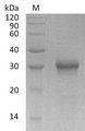 FGF17 Protein - (Tris-Glycine gel) Discontinuous SDS-PAGE (reduced) with 5% enrichment gel and 15% separation gel.