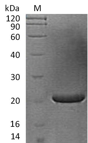 FGF17 Protein - (Tris-Glycine gel) Discontinuous SDS-PAGE (reduced) with 5% enrichment gel and 15% separation gel.